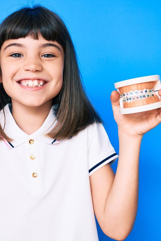 Pasang Kawat Gigi di Usia Berapa? Penjelasan Lengkap dari Dental Klinik Circle Dental Bali