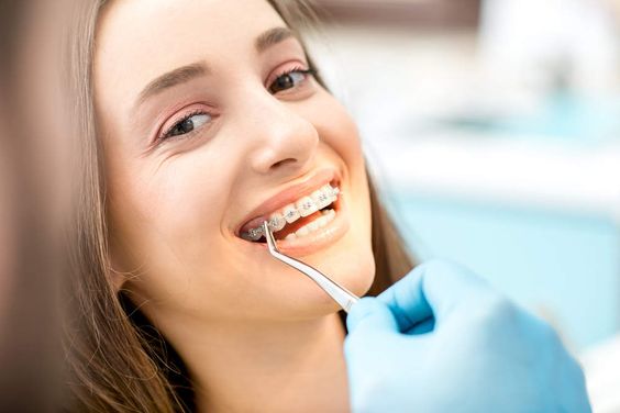 Perbaiki Gigi Anda dengan Pasang Veneer Gigi di Dental Klinik Circle Dental Bali